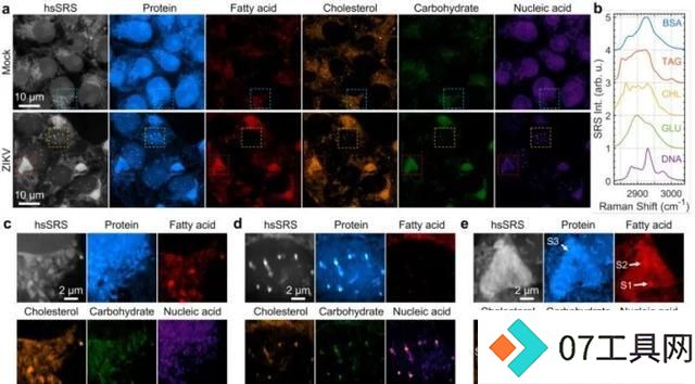科学家用AI开发受激拉曼纳米成像技术,分辨率可达86纳米 科学家用AI开发受激拉曼纳米成像技术,分辨率可达86纳米