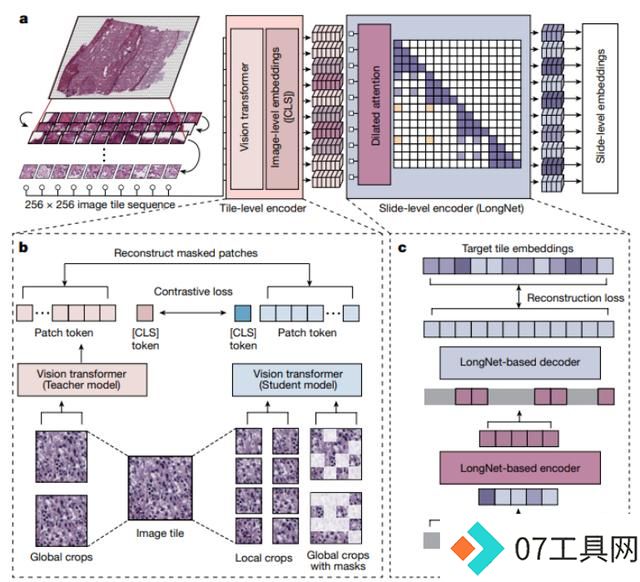 AI病理学大模型革新癌症诊断,科学家揭秘技术突破 AI病理学大模型革新癌症诊断,科学家揭秘技术突破