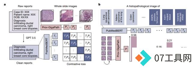 AI病理学大模型革新癌症诊断,科学家揭秘技术突破 AI病理学大模型革新癌症诊断,科学家揭秘技术突破
